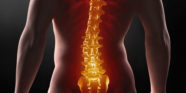 Dor insoportable na parte baixa das costas - un síntoma do III. Etapas da osteocondrose lumbar