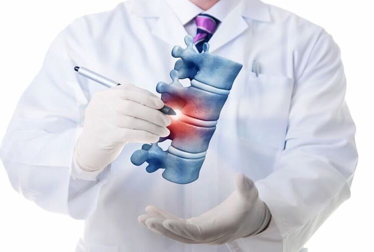 Lesións da columna vertebral por osteocondrose torácica